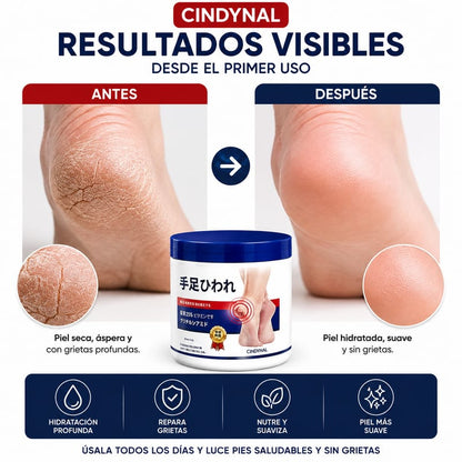 💧 Crema Reparadora Intensiva para Talones Resecos y Piel Áspera | Urea 25% + Vitamina E