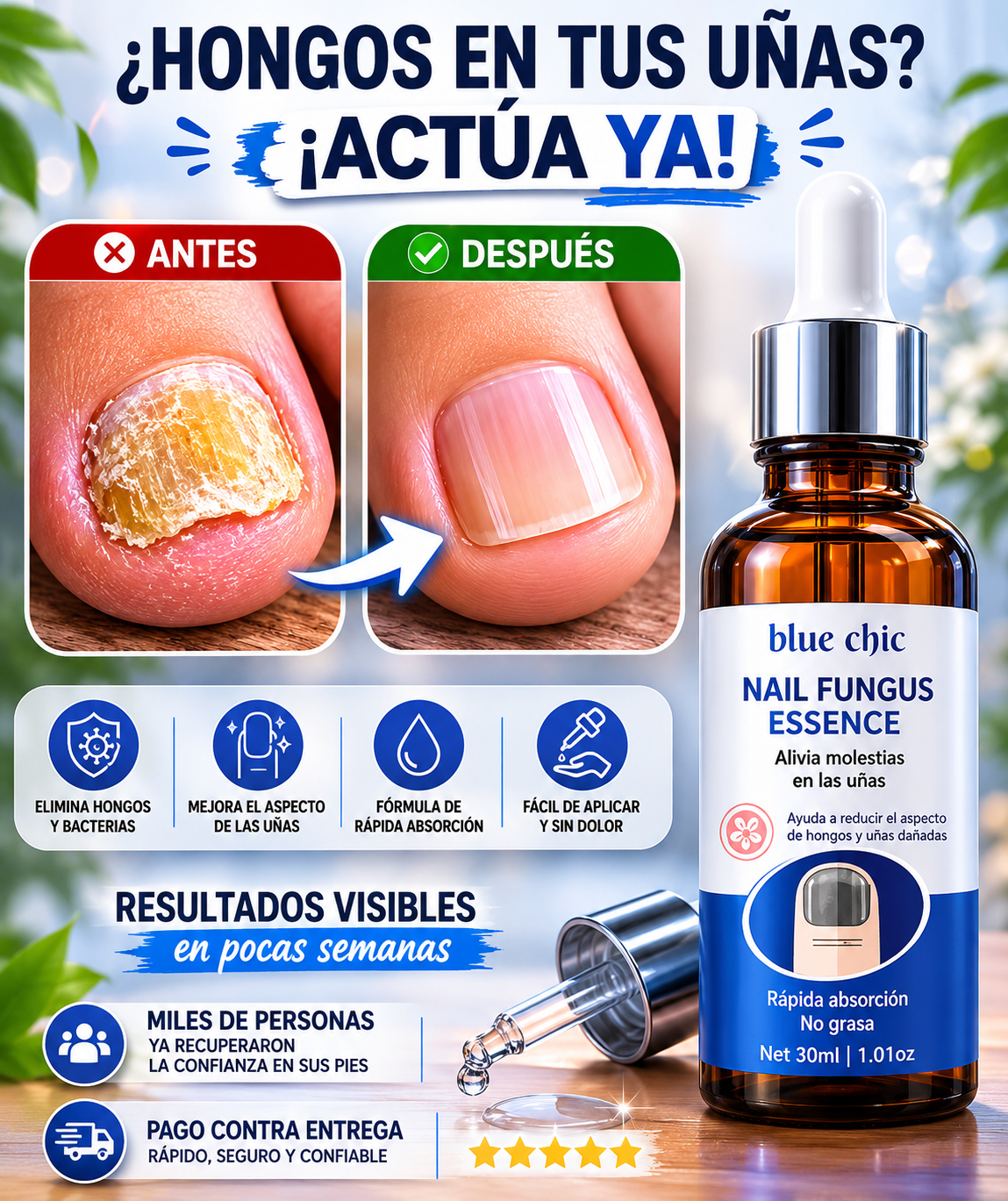 Nail Fungus Essence | Tratamiento para mejorar uñas con hongos + EBOOK GRATIS "Elimina los Hongos y Evita que Regresen"