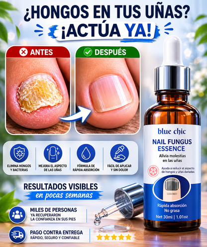 Nail Fungus Essence | Tratamiento para mejorar uñas con hongos + EBOOK GRATIS "Elimina los Hongos y Evita que Regresen"