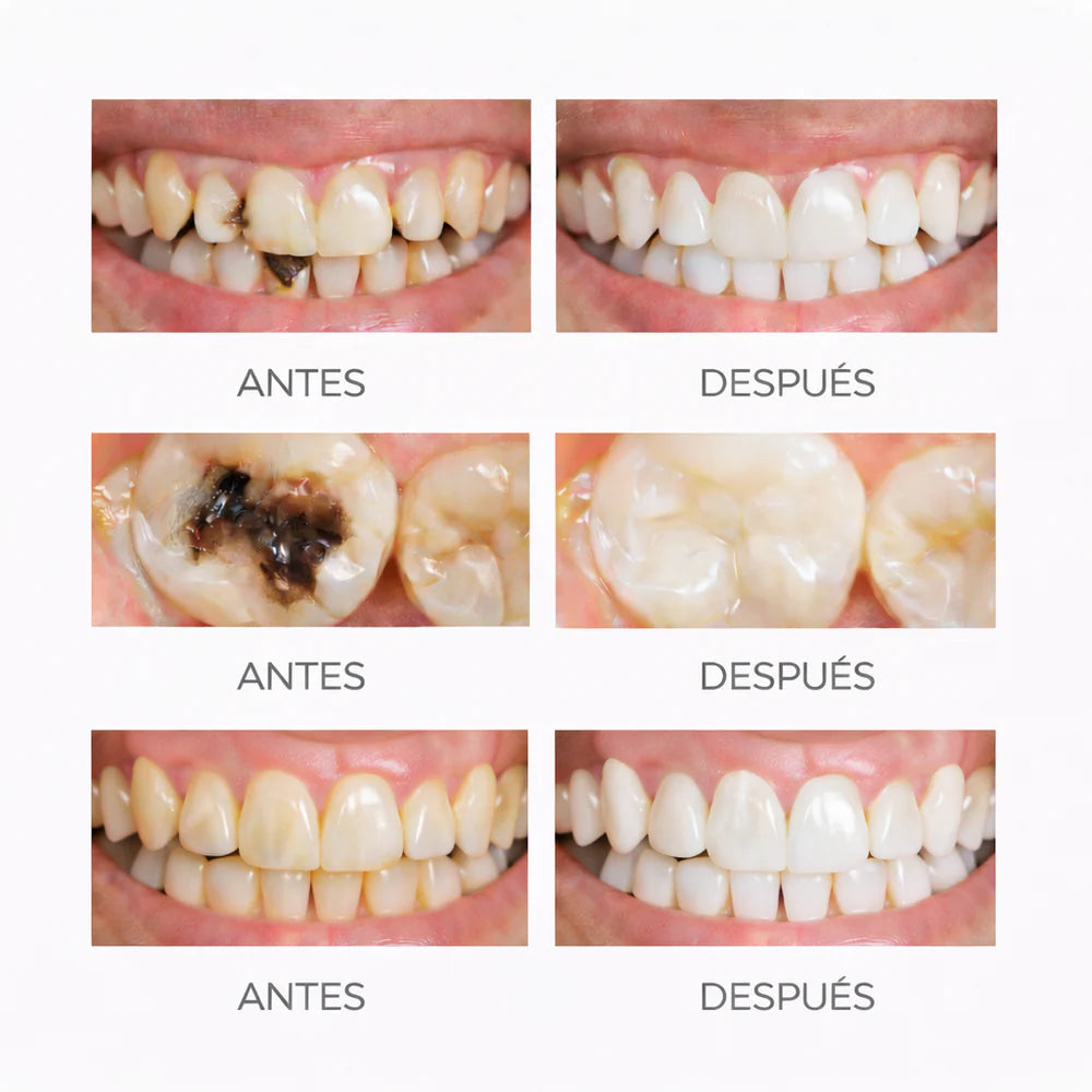 “Dental Shield Pro™ | "Ayuda a reparar dientes sensibles y debilitados”