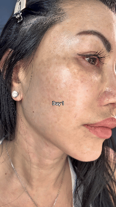 Dr. Melaxin TX-Cream™ | Ayuda a Reducir Manchas y Recuperar un Tono Uniforme ✨
