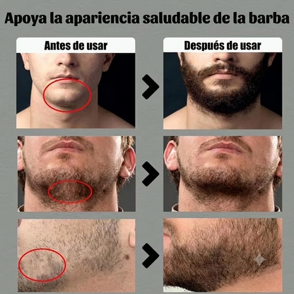 Apolo Ultra Potente™ | Bálsamo para una Barba con Apariencia Más Densa y Definida