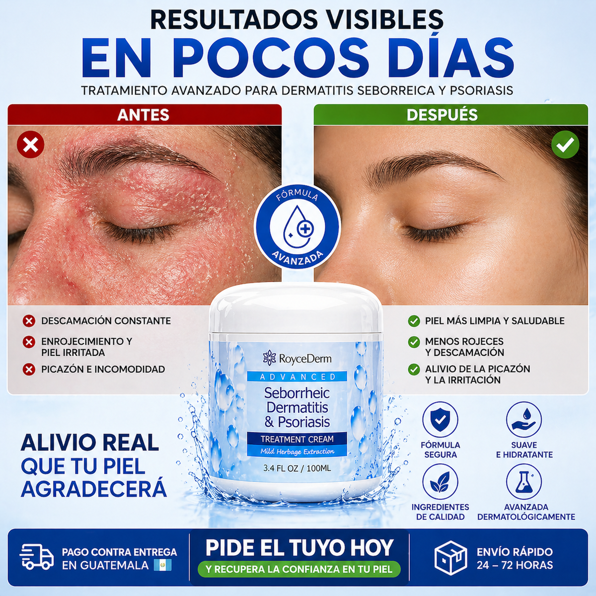 RoyceDerm Advanced – Controla la descamación y calma la irritación de tu piel