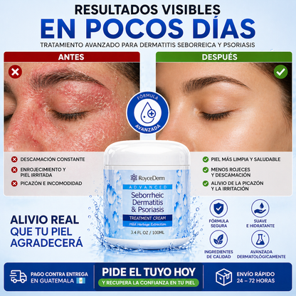 RoyceDerm Advanced – Controla la descamación y calma la irritación de tu piel