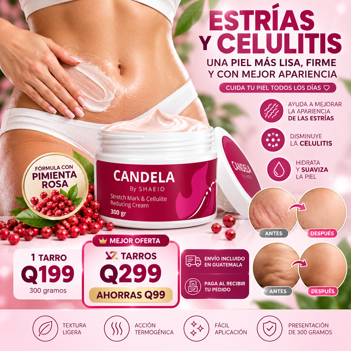 CANDELA™ |💖 Crema Corporal para el Cuidado de Estrías y Celulitis – 300 g