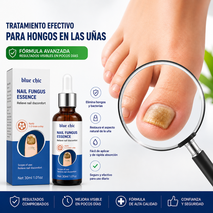 Nail Fungus Essence | Tratamiento para mejorar uñas con hongos + EBOOK GRATIS "Elimina los Hongos y Evita que Regresen"