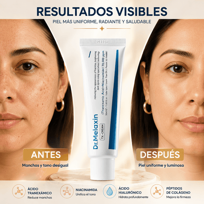 Dr. Melaxin TX-Cream™ | Ayuda a Reducir Manchas y Recuperar un Tono Uniforme ✨