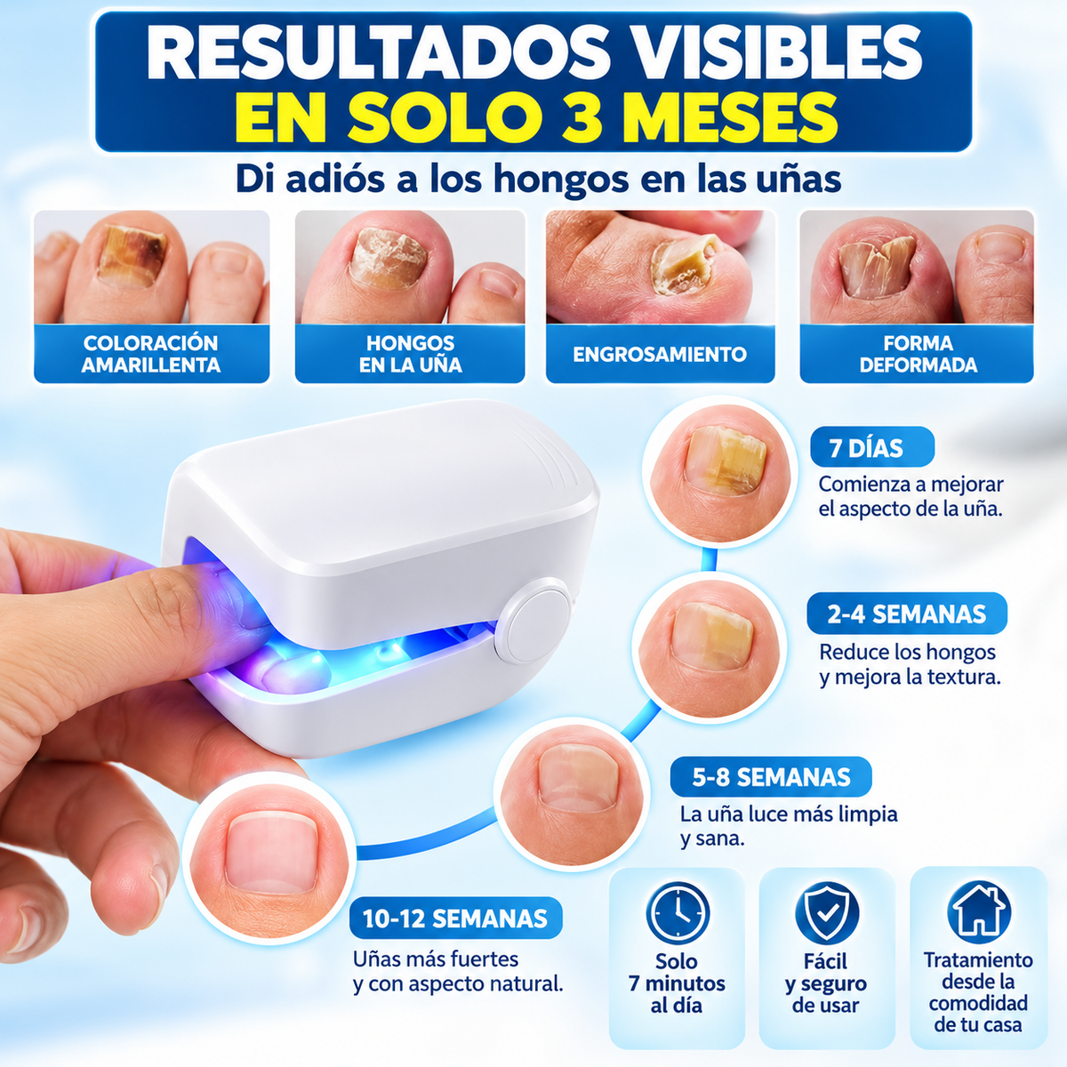 NailLight Pro™ – Láser Antihongo Para Uñas