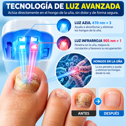 NailLight Pro™ – Láser Antihongo Para Uñas